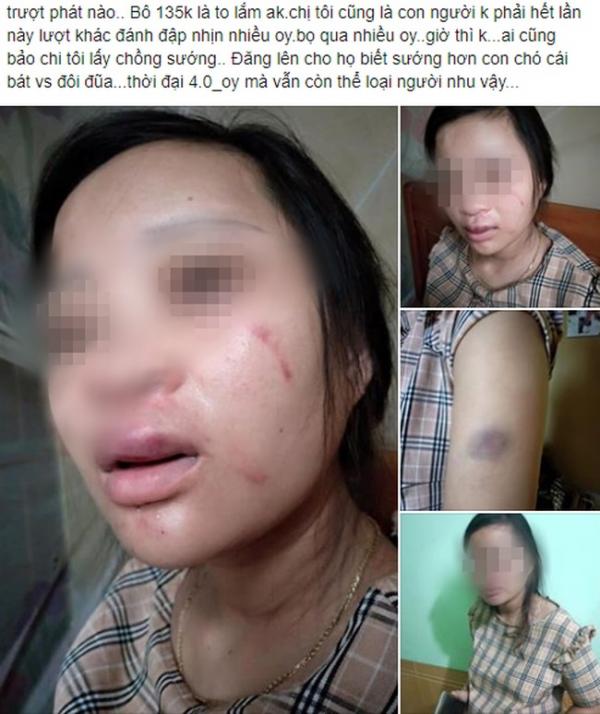 Vụ bà bầu mua giày 135k bị chồng đánh động thai, tiểu ra máu: Gia đình chồng thuộc diện khá giả